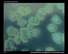 pseudomonas aeruginosa on cetrimide agar